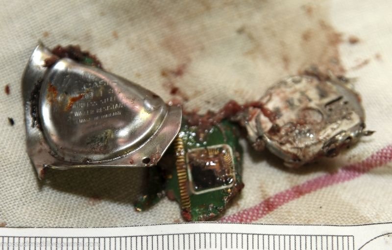 Последствия взрывов на «Парке культуре»: деформированный корпус от наручных часов, который обнаружили в ткани мозга - фото 30 из книги «Вскрытие покажет» Последствия взрывов на «Парке культуре»: деформированный корпус от наручных часов, который обнаружили в ткани мозга - фото 30 из книги «Вскрытие покажет»